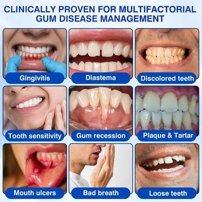 GumShield Periodontal Care Gel