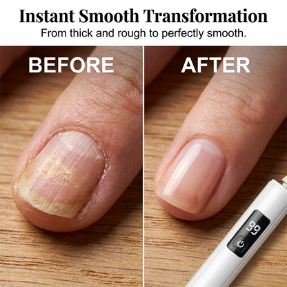 🥳💞HOT SALE 50% OFF💅✨Professional Electric Nail Polisher – Smooths thick nails, 99-speed display. Multiple heads for shaping & buffing. Salon at home! 🌟💎